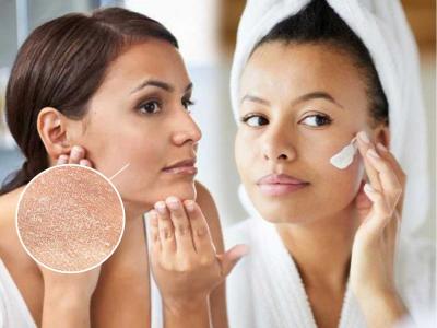 थंडीमुळे त्वचा कोरडी पडून चेहरा भुरकट दिसतो? चेहऱ्यावर शिंपडा 'हे' पाणी, त्वचा हायड्रेटेड राहील