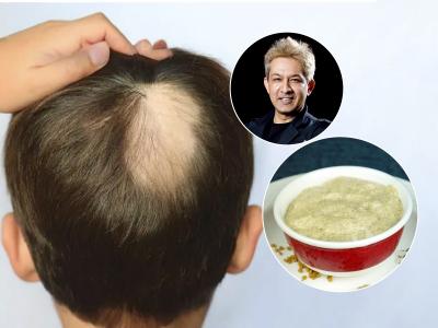 लहान मुलांचेही केस खूप गळू लागले? जावेद हबीब सांगतात मुलांच्या नाजुक केसांसाठी सोपा उपाय