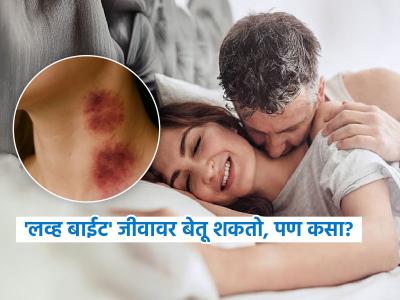 सेलिब्रिटी मिरवतात म्हणून तुम्हीही दाखवत फिरू नका लव्ह बाईट, भयंकर इन्फेक्शनचा धोका.. जीवावरही बेतू शकतं