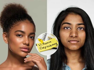 फेशियल, क्लिनअप करूनही चेहरा काळवंडलेलाच? 'या' व्हिटॅमिन्सचे पदार्थ खा, त्वचा होईल तुकतुकीत