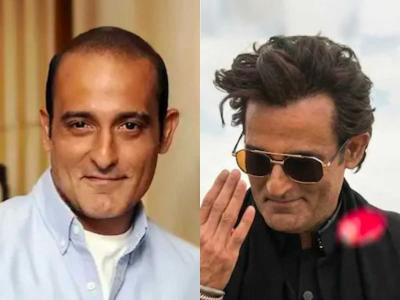 Dhurandhar : केस गळतीची समस्या असूनही 'धुरंधर'मध्ये अक्षय खन्नाचे केस इतके सुंदर का दिसतात?