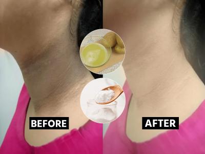 चेहरा गोरा, पण मान खूपच काळवंडली? ३ पदार्थ मानेवर चोळा, १० मिनिटांत मान स्वच्छ