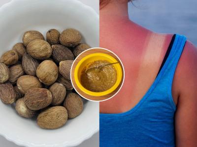 उन्हामुळे सनबर्नचा त्रास- टॅनिंगही वाढलं? जायफळाचा 'असा' लेप लावा, काळवंडलेली त्वचा होईल उजळ