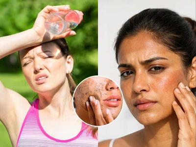 उन्हात गाडीवर फिरल्याने हात, कपाळ काळवंडून गेलं? बघा टॅनिंग कमी करणारे २ झटपट उपाय