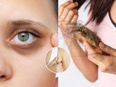 तुम्हाला प्रचंड स्ट्रेस आलाय,ओव्हर थिंकिंग करुन डोकं फुटेल-हे सांगणारी ५ लक्षणं, दुर्लक्ष पडेल महागात