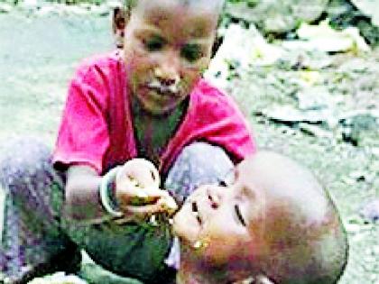 Malnutrition re-surveyed in the district | जिल्ह्यात कुपोषणाचे फेरसर्वेक्षण