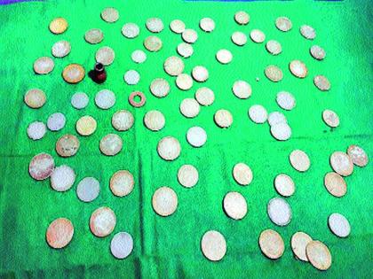 Maneurgane's brain exits 72 coins! Habitat Betli Jeevar: Surgery in Patiala District, Nashik | मनोरुग्णाच्या पोटातून काढली तब्बल ७२ नाणी! सवय बेतली जीवावर : पालघर जिल्ह्यातील रुग्णावर नाशिकमध्ये शस्त्रक्रिया