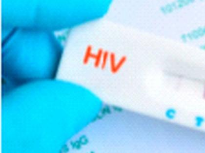 84 AIDS patients were found during the lockdown | लॅाकडाऊनच्या काळात आढळले ८४ एड्‌स रुग्ण