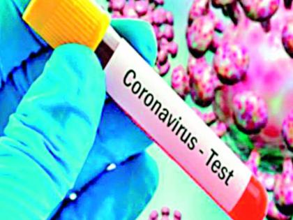 Manipulation in contact tracing; Neglected to test five people in positive contact | कॉन्टॅक्ट ट्रेसिंगमध्ये होतेय चालढकल; पॉझिटिव्हच्या संपर्कातील पाच जणांची चाचणी करण्याकडे दुर्लक्षच Manipulation in contact tracing; Neglected to test five people in positive contact | कॉन्टॅक्ट ट्रेसिंगमध्ये होतेय चालढकल; पॉझिटिव्हच्या संपर्कातील पाच जणांची चाचणी करण्याकडे दुर्लक्षच