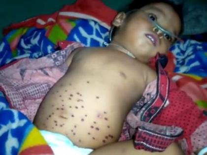 Cruel treatment to Sick child in Melghat | मेळघाटात आजारी बालकाच्या पोटावर गरम विळ्याचे 'डंबे'