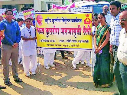 Public awareness through rallies to eradicate leprosy | कुष्ठरोग निर्मूलनाबाबत रॅलीच्या माध्यमातून जनजागृती