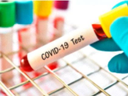 District leads in corona tests | कोरोना चाचण्यांमध्ये जिल्हा आघाडीवर District leads in corona tests | कोरोना चाचण्यांमध्ये जिल्हा आघाडीवर