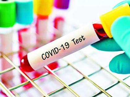 The target is 2 thousand 160 Carana tests per day | दररोज 2 हजार 160 काेराेना चाचण्यांचे उद्दिष्ट