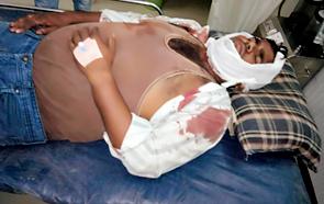 Crash of Gutkha Dealer Kaka-Putat | गुटखा विक्रेत्या काका-पुतण्यात हाणामारी Crash of Gutkha Dealer Kaka-Putat | गुटखा विक्रेत्या काका-पुतण्यात हाणामारी