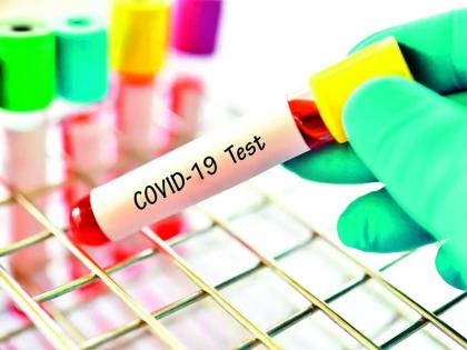 Decrease in positivity rate even after increasing covid test | कोविड टेस्ट वाढविल्यानंतरही पॉझिटिव्हीटी दरात घसरण