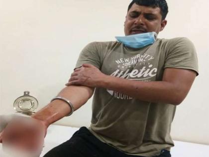 Coronavirus Lockdown : During the lockdown, the soldier's hand's fingers was cut off pda | Coronavirus Lockdown : खेदजनक! लॉकडाऊनदरम्यान पहारा देणाऱ्या जवानाच्या हाताची बोटं कापली