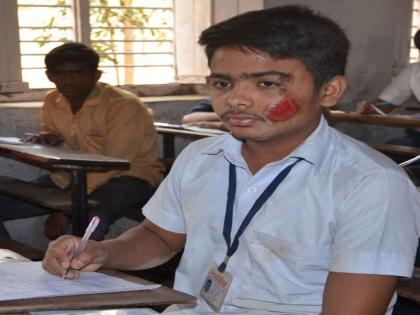 Even after being injured in an accident in Dhule, the students gave the paper | धुळे येथे अपघातात जखमी होवूनही विद्यार्थ्यांनी दिला पेपर