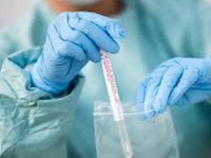 कोरोनाचा सध्या जिल्ह्यात ‘ब्रेक’