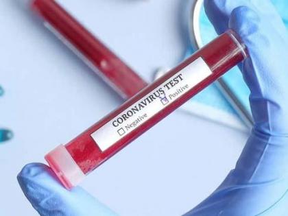 Coronavirus: not enough tests from states; Maharashtra needs to increase tests, Center concerned | Coronavirus:राज्यांकडून पुरेशा चाचण्या नाहीत; महाराष्ट्राने चाचण्या वाढवण्याची गरज, केंद्र चिंतेत