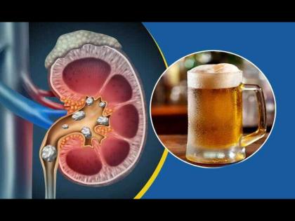 Why alcohol is not good for your kidney | किडनीसाठी कशी नुकसानकारक आहे दारू? कारण वाचाल तर पिणं सोडाल