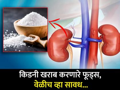 World Kidneys Day: Worst foods for your kidney avoid these foods | किडनी खराब करणारे फूड्स जे आपण रोज खातो, जास्त खाणं पडू शकतं महागात!