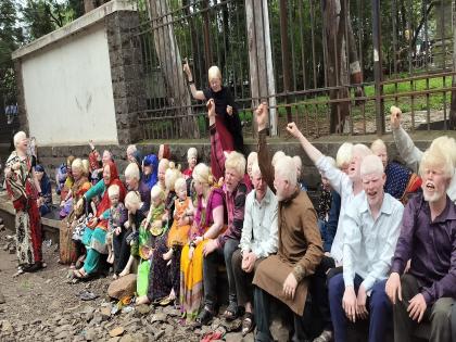 For the first time, the people who were crushed by the struggle given by the white color in Kolhapur came to the streets and protested in front of the collector office | Kolhapur: शुभ्र काही जीवघेणे.. गोपाळ समाजाचे वेदनामय जिणे; शासकीय योजनांचा लाभ नाही 