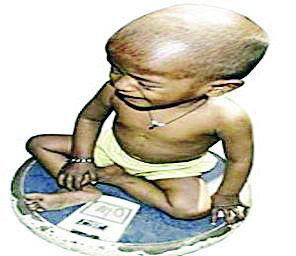 Five thousand children were found malnourished | पाच हजार बालके आढळली कुपोषित Five thousand children were found malnourished | पाच हजार बालके आढळली कुपोषित