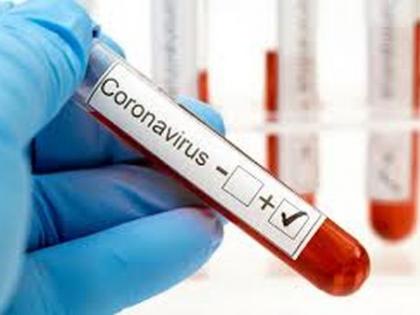 Corona crosses Hazara in Nandurbar, 62 positive | नंदुरबारात कोरोना हजाराच्या पार, ६२ पॉझिटिव्ह Corona crosses Hazara in Nandurbar, 62 positive | नंदुरबारात कोरोना हजाराच्या पार, ६२ पॉझिटिव्ह
