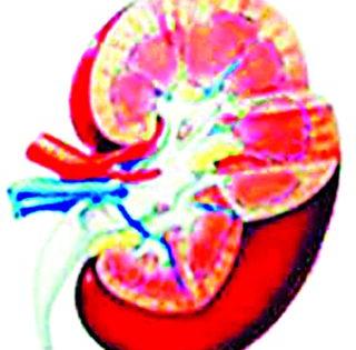 Be careful! Kidney Disease Increase | सावधान! मूत्रपिंडाच्या आजारात वाढ