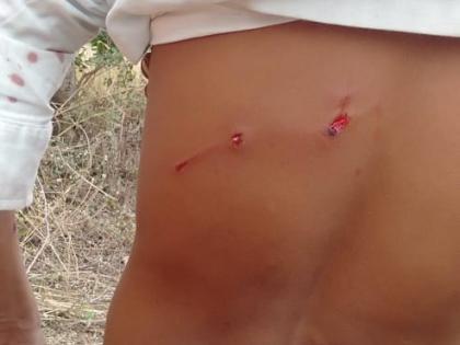 Leopard attacks youth in Bhardupari field | बिबट्याचा भरदुपारी शेतात युवकावर हल्ला