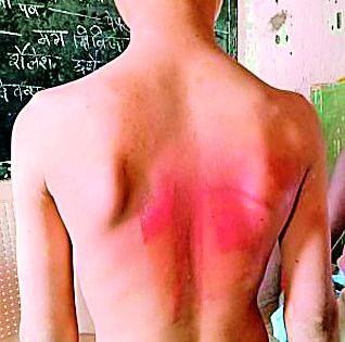 Adivasi student suffers beatly | आदिवासी विद्यार्थ्याला बेदम मारहाण