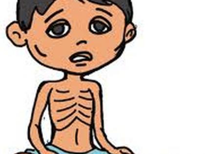 Weight locks of 'eight and a half lakh' children in the state | राज्यातील ‘साडेआठ लाख’ बालकांचे ‘वेट लॉक’ Weight locks of 'eight and a half lakh' children in the state | राज्यातील ‘साडेआठ लाख’ बालकांचे ‘वेट लॉक’