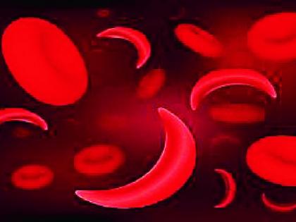 Sickle cell awareness | सिकलसेल जनजागृती तोकडीच