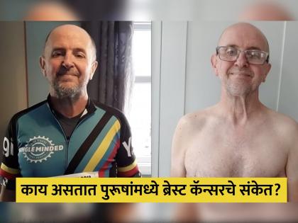 Men breast cancer a runner diagnosed with breast cancer know the symptoms | पुरूषाला झाला ब्रेस्ट कॅन्सर, उपचारानंतर सांगितलं या लक्षणांकडे करू नका दुर्लक्ष