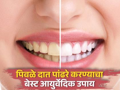 Teeth Whitening Tips : Tips and remedies for teeth whitening at home | दात पांढरे करण्यासाठी डॉक्टरांना द्यावे लागणार नाही पैसे, घरीच तयार करा 'हे' खास पावडर...