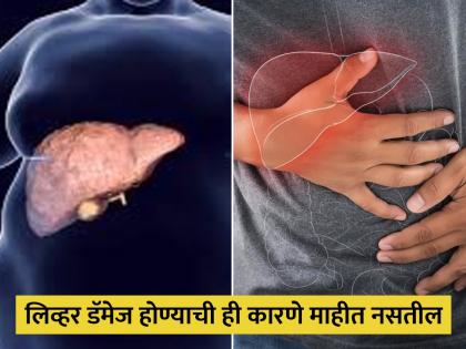 These bad habits can leads to liver damage anger day time sleep late night wake up | अनहेल्दी फूड्सच नाही तर या 3 सवयींमुळे लिव्हर होतं कमजोर, वेळीच व्हा सावध!