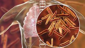 Kolhapur Municipal Corporation first in the state in eradication of tuberculosis | क्षयरोग दुरीकरणात कोल्हापूर महापालिका राज्यात प्रथम