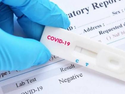 Corona virus : The number of corona-free patients is higher than the number of infected people in Pimpri-Chinchwad | Corona virus : पिंपरी-चिंचवड शहरात नवीन बाधितांपेक्षा कोरोनामुक्त रुग्णांची संख्या सोमवारी जास्त