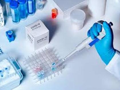 The laboratory started in three shifts | तीन शिफ्टमध्ये सुरू झाली प्रयोगशाळा The laboratory started in three shifts | तीन शिफ्टमध्ये सुरू झाली प्रयोगशाळा