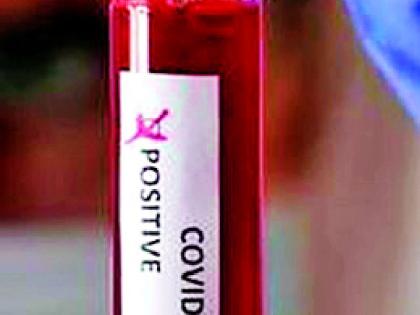 3658 rapid antigen tests in two months | दोन महिन्यात ३६५८ रॅपिड अँटिजेन चाचण्या 3658 rapid antigen tests in two months | दोन महिन्यात ३६५८ रॅपिड अँटिजेन चाचण्या