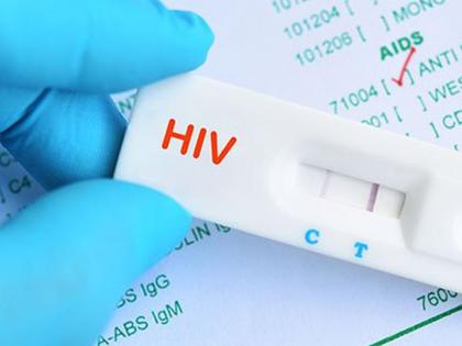 20,000 HIV tests during lockdown | लॉकडाऊनच्या काळात २० हजार एचआयव्ही टेस्ट