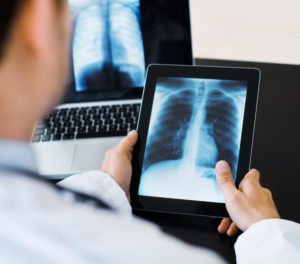 Digital X-ray reporting service | डिजिटल एक्स-रे रिर्पोटिंग सेवा