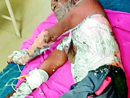 The laborers burnt down from the street as lightning struck the stars | चैलीवरून वीज तारेवर कोसळल्याने मजूर भाजला The laborers burnt down from the street as lightning struck the stars | चैलीवरून वीज तारेवर कोसळल्याने मजूर भाजला