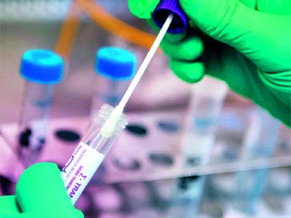 The establishment will remain closed if the corona is not tested | कोरोना चाचणी न केल्यास प्रतिष्ठान राहणार बंद The establishment will remain closed if the corona is not tested | कोरोना चाचणी न केल्यास प्रतिष्ठान राहणार बंद