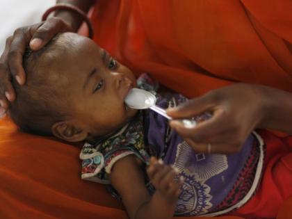 Inadequate nutrition increases the risk of infection in children | अपुऱ्या पोषक घटकांमुळे बालकांमध्ये संसर्गाचा धोका अधिक