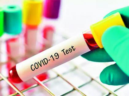 Tests of over 5 lakh people; 55 thousand Wardhekar positive | तब्बल 5 लाख लोकांची टेस्ट; 55 हजार वर्धेकर पॉझिटिव्ह Tests of over 5 lakh people; 55 thousand Wardhekar positive | तब्बल 5 लाख लोकांची टेस्ट; 55 हजार वर्धेकर पॉझिटिव्ह
