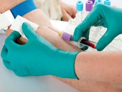 Five blood samples in the laboratory | पाच जणांचे रक्त नमुने प्रयोगशाळेत