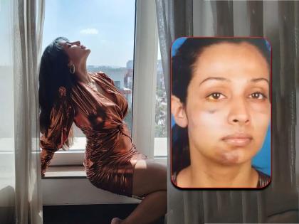 'He'd punch my private parts': Actress Flora recalls being mercilessly bashed by her producer boyfriend