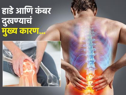 Bone density cause vitamin d deficiency symptoms | हाडांमधून आवाज येतो? सतत कंबर दुखते? समजून घ्या 'हे' व्हिटॅमिन शरीरात कमी झालंय!