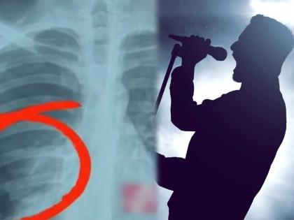 China : Man lung collapsed singing song at high volume at friends birthday | मित्राच्या वाढदिवशी तरूणानं इतक्या जोरात गायलं गाणं, गाता गाता फुप्फुस फुटलं!